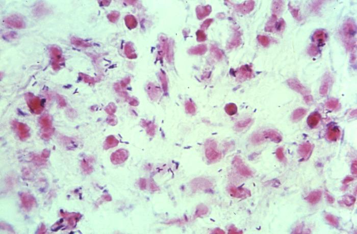 Descriptive text is not available for this image