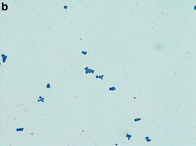 Colorazione negativa per staphylococcus epidermidis