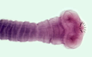 タエニア　TAENIA Taenia solium | Johns Hopkins ABX Guide