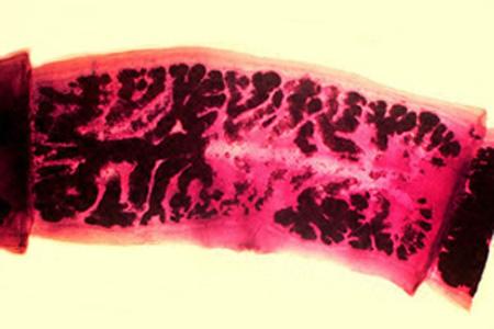 タエニア　TAENIA Taenia solium | Johns Hopkins ABX Guide