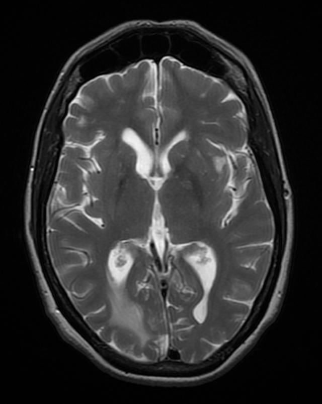 Descriptive text is not available for this image