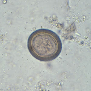 タエニア　TAENIA Taenia saginata | Johns Hopkins ABX Guide