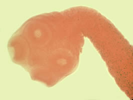 Taenia saginata | Johns Hopkins ABX Guide